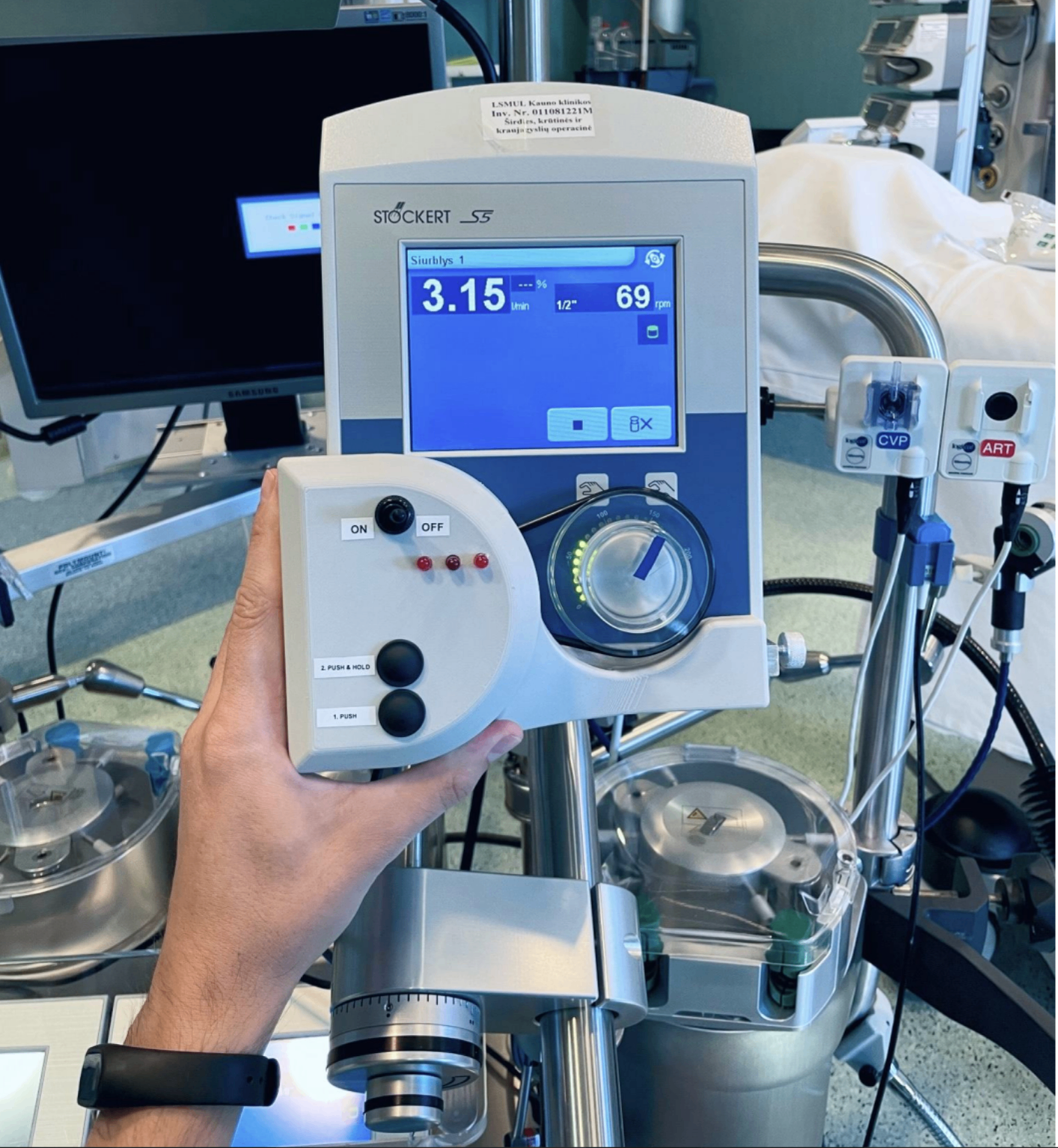 BrainProtect | AI-Powered Brain Protection for CPB Surgery, ECMO & ICU ...